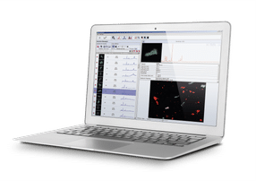 ParticleScout – an advanced analysis tool for faster detection, classification and identification of microparticles