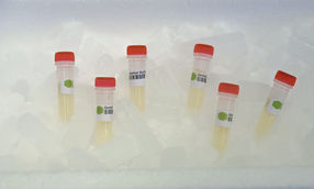 Cerebrospinal Fluid (CSF)