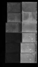 Protein Subarray nach Inkubation mit Serum und Zweitantikörper und Reaktion mit fluoreszierendem Substrat