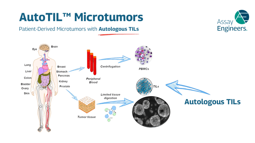 Microtumeurs dérivées de patients avec TILs autologues ...