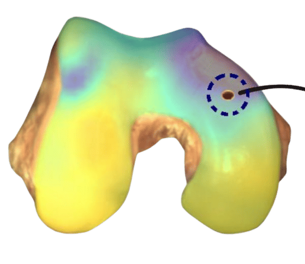 Secuencia de ensayos mecánicos en una única localización ...