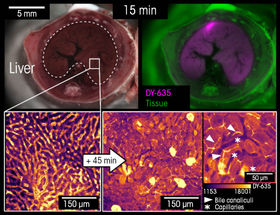Fig. 1 Biophotonic tracking of nanoformulated PI3Kγ inhibitors in the liver.