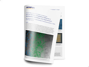 Whitepaper “Vorteile von Deep Learning-Ansätzen in der Mikroskopie“