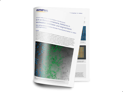 „Deep Learning“ und KI in der Mikroskopie: markierungsfreie Zellkern-Detektion in Mikrotiterplatten