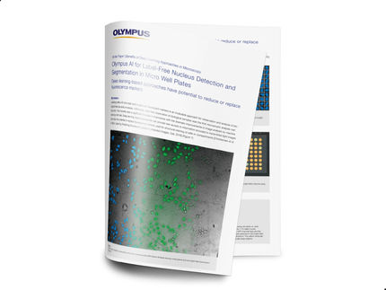 Benefits of Deep Learning and AI in Microscopy: Label-Free Nucleus Detection in Micro Well Plates