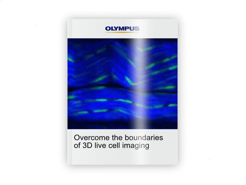 Overcome the boundaries of 3D live cell imaging - How to increase throughput using 2-Photon microscopy of 3D cellular models in drug discovery