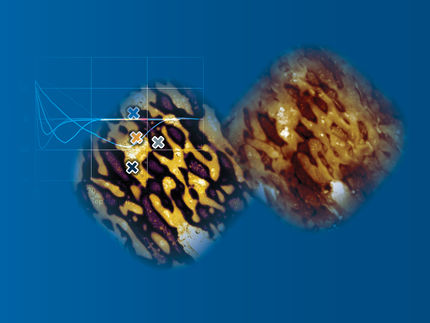 Nanomechanical Characterization with AFM